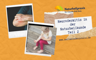 Neurodermitis in der Naturheilkunde (Teil 2)